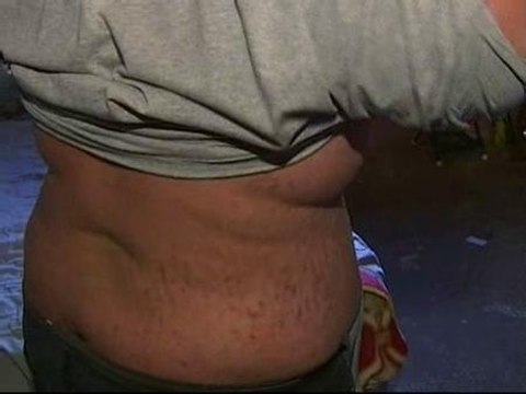 Investigan un extraño caso de obesidad de un adolescente cordobés