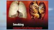 Las cejetillas mostrarán las consecuencias del tabaquismo
