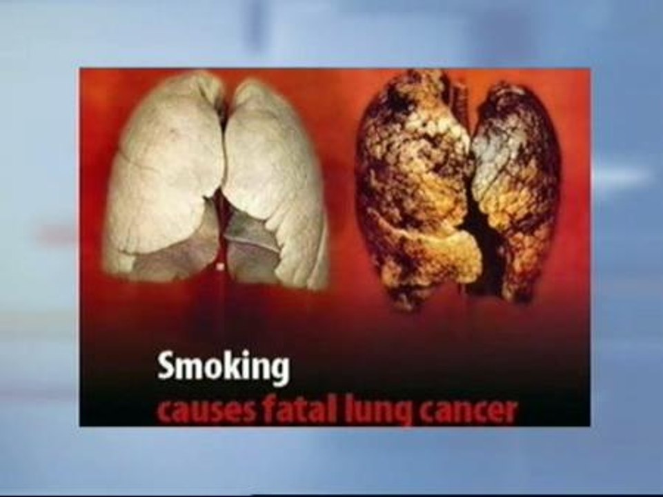 Las cejetillas mostrarán las consecuencias del tabaquismo