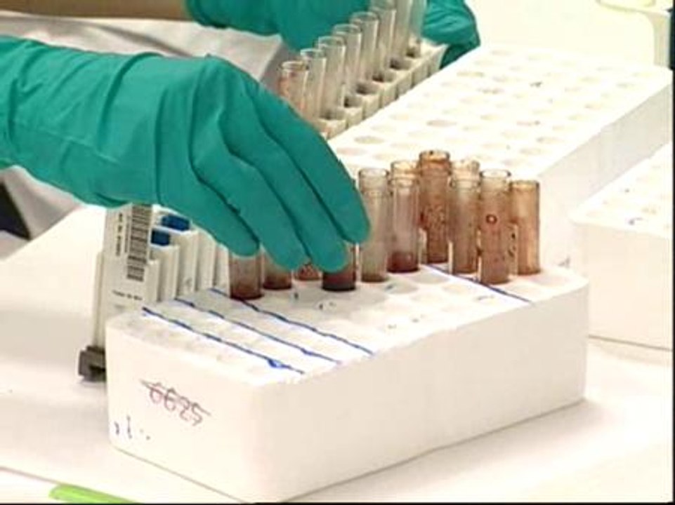 ¿Cuáles son los síntomas de la gripe porcina?