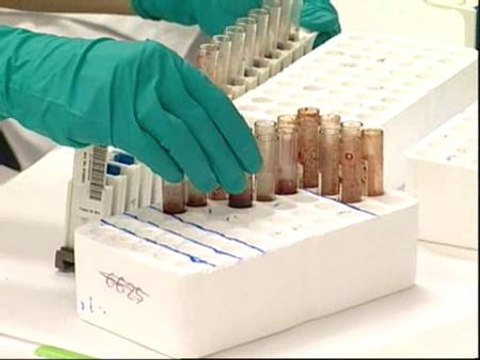 ¿Cuáles son los síntomas de la gripe porcina?