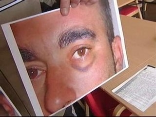 Juzgan a tres mossos por agredir a un detenido ilegalmente
