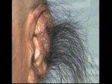 Los pelos más largos en las orejas