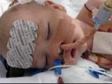 Curan la arritmia a un bebé británico de cuatro meses congelándole el corazón