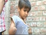 Treinta niños indios nacen ciegos o con extremidades amputadas