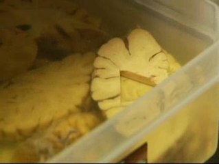 Aumenta la donación de cerebros en España