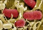 Los expertos descartan que la bacteria E.Coli pueda propagarse a otros países
