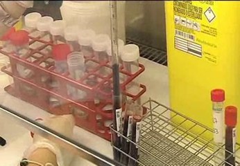 Localizan la molécula por la que se propaga el virus del SIDA