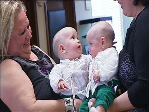 Vall d'Hebron separa a dos siamesas