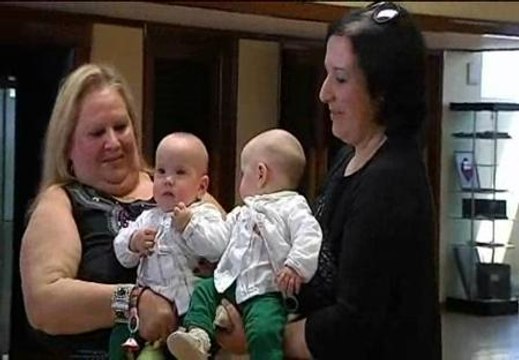 Separadas dos siamesas unidas por el abdomen y el hígado