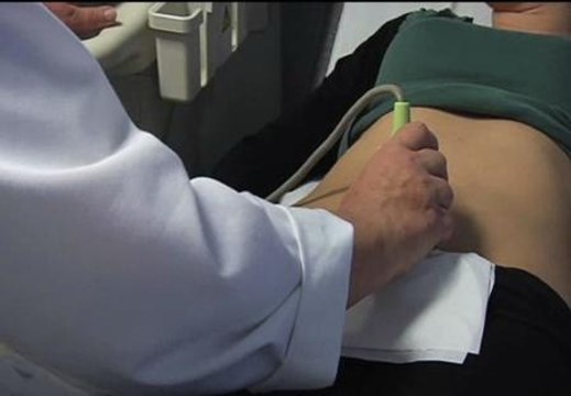 Las mujeres de Baleares deberán adelantar el dinero si desean abortar