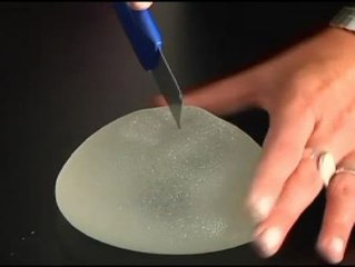 Las mujeres exigen una indemnización por el mal estado de los implantes