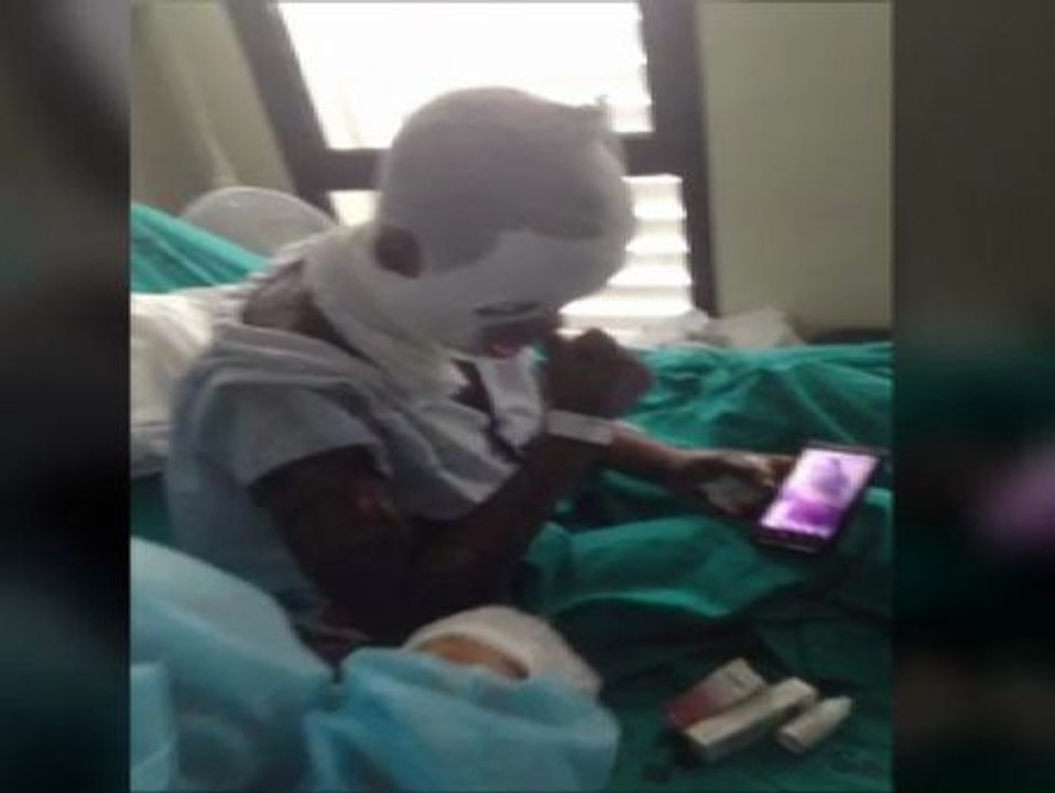 Un hombre ordena que quemen con ácido a su mujer