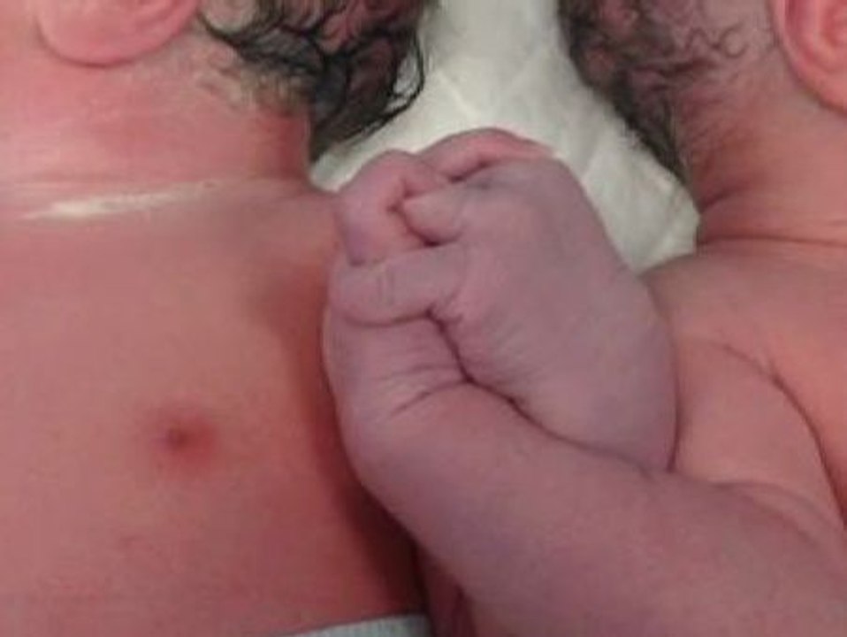 El ginecólogo que atendió a los mellizos de la foto habla de una "conexión especial" entre ellos