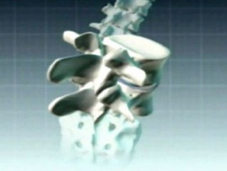 La operación del Rey