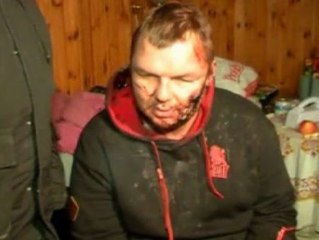 Torturan a un opositor ucraniano :"Tengo agujeros en las manos, me crucificaron"