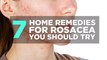 7 Home Remedies for Rosacea You Should Try