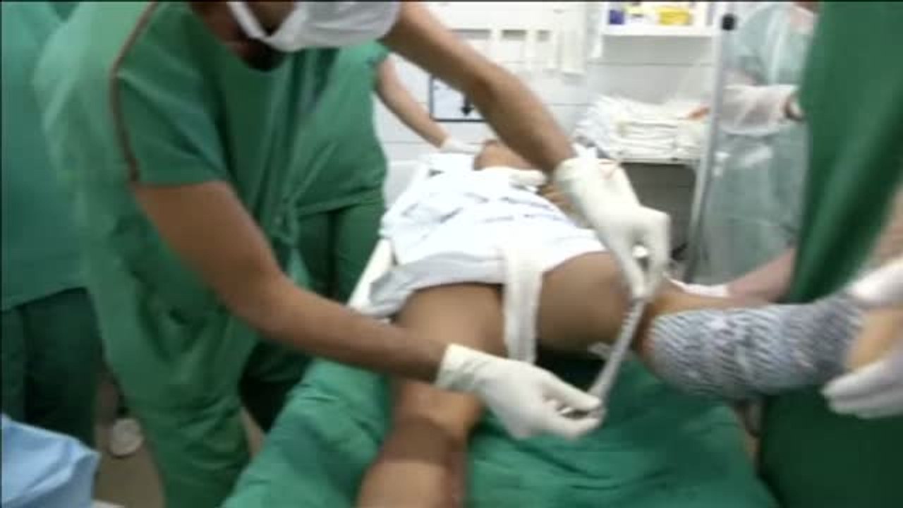 Doctores en Brasil usan piel de peces para tratar las quemaduras