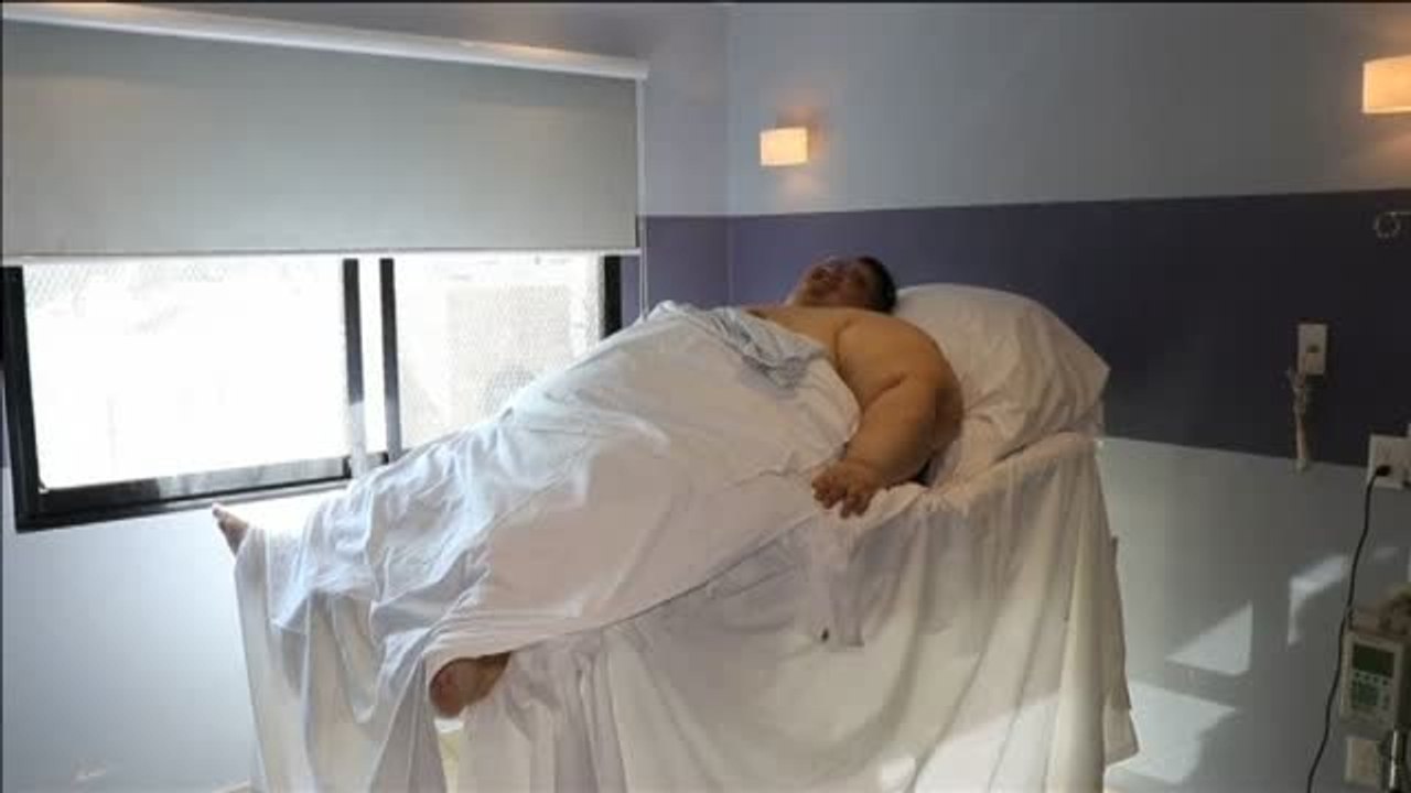 Recibe el alta médica el hombre más obeso del mundo