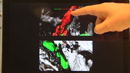 Un medicamento de menos de dos euros capaz de reducir el daño que produce un infarto en el corazón