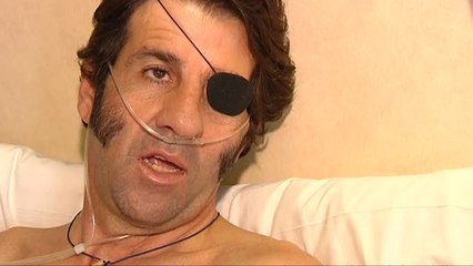 Juan José Padilla continúa con su recuperación tras las cornadas en la axila y la pierna
