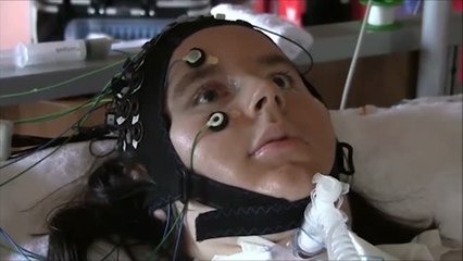 No mueve ni las pestañas pero se puede comunicar