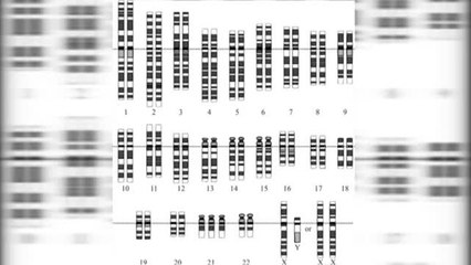 Las &#039;21 razones&#039; de Madeline Stuart sobre la pasarela