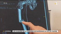 Tahiti et Moorea accueillent les 39e journées de l’orthopédie outremer