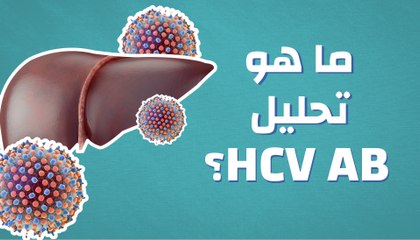 ما هو تحليل (HCV AB)؟