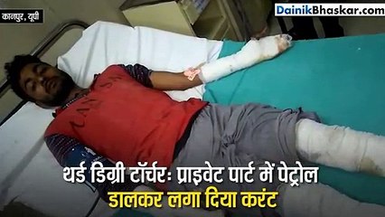 प्राइवेट पार्ट में पेट्रोल डालकर लगाया करंट