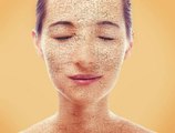 Peau sèche : 4 recettes de soins du visage