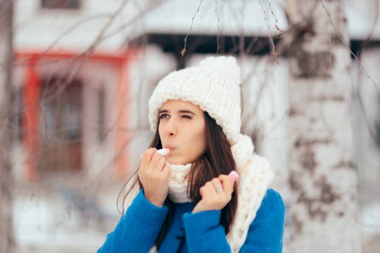 Lèvres gercées : 4 ingrédients miracles pour les soigner