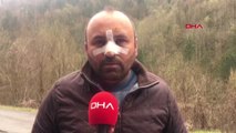 Zonguldak 'Ucuz Ekmek' Kavgasından Burnu Kırıldı-2