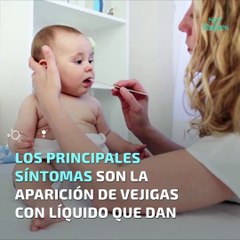 Llagas en la boca del bebé