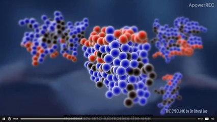 What cause dry eyes Pay a visit to eye doctor