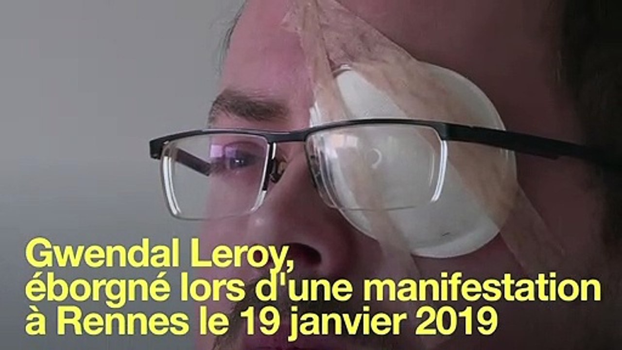 "Gilet jaune" éborgné: Gwendal Leroy, demandeur d'emploi