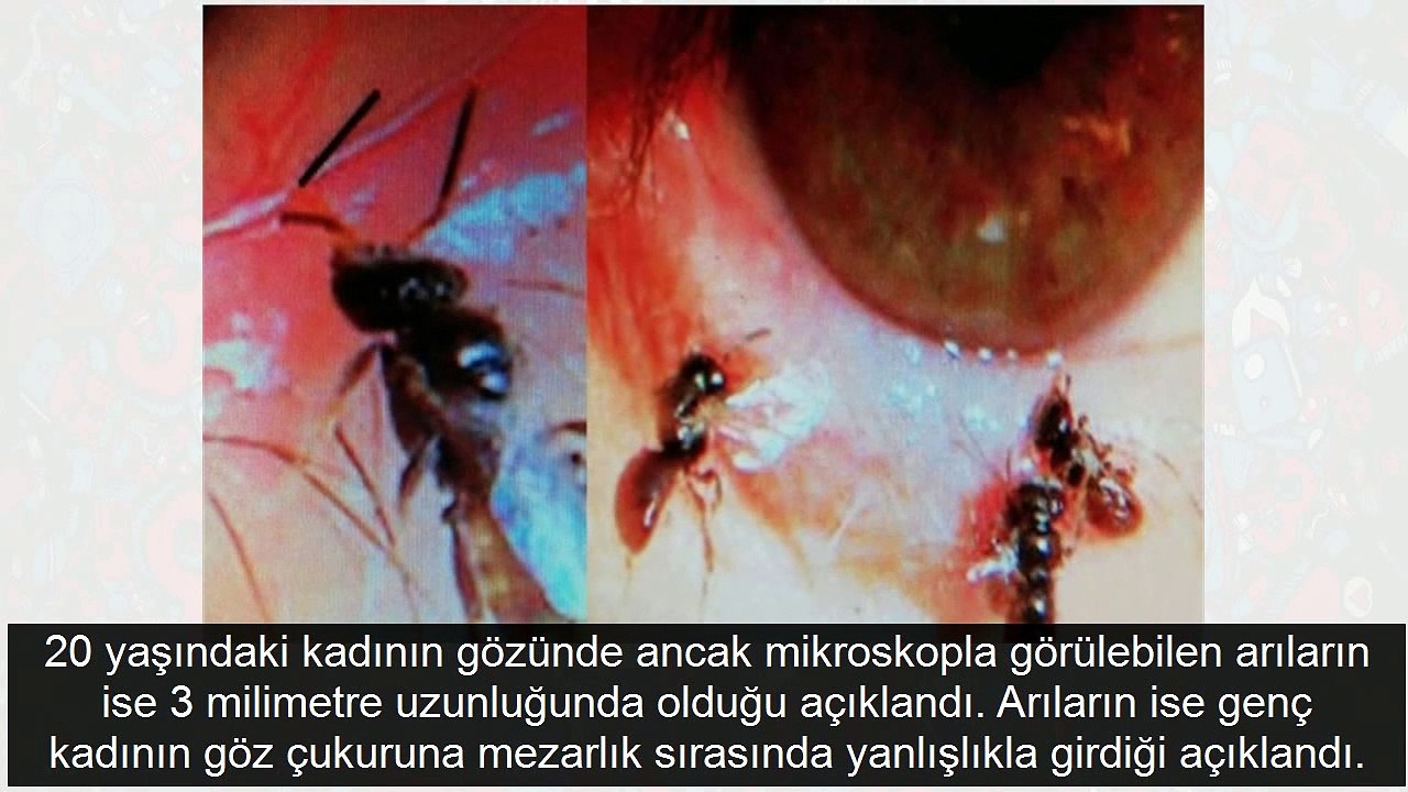 Dünya'da bir ilk arılar gözünde yuva yaptı!
