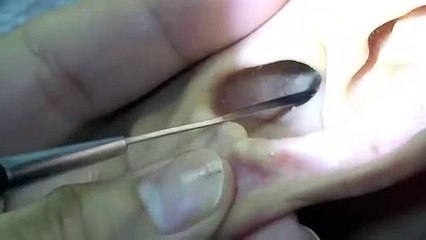 밀양출장안마 #P# 후불100%ョ｛Ø7Ø↔7575↔0069카톡CK654｝밀양전지역출장마사지밀양출장안마밀양출장마사지'만족Ф출장마사지출장마사지