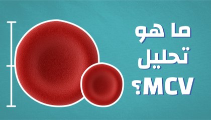 ما هو تحليل (MCV)؟