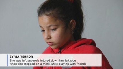 The Syrian children maimed in the wake of the Islamic State