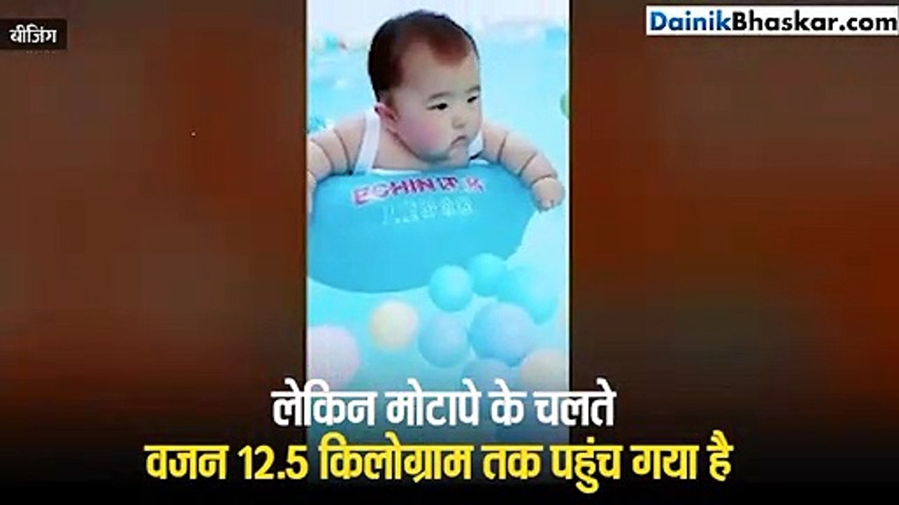 चीनः मोटापे से 6 महीने की बच्ची के हाथों में पड़ गए घुमावदार रोल