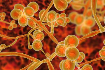 Début d’épidémie mondiale : le Candida auris