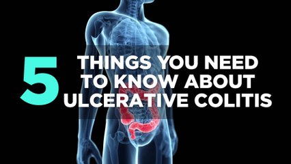 5 Things You Need to Know About Ulcerative Colitis