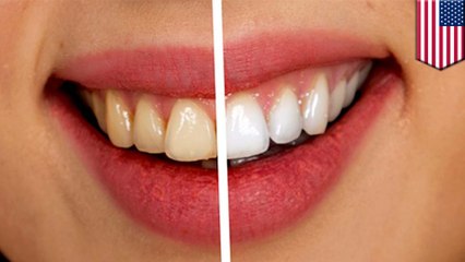 How whitening strips damage your teeth