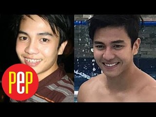 Jak Roberto on nose job rumor: "Puwede naman."