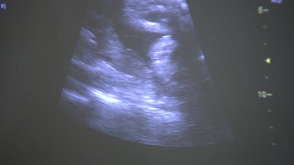 "임신 22주까지 낙태 허용해야"...7년 만에 뒤집힌 판단 / YTN