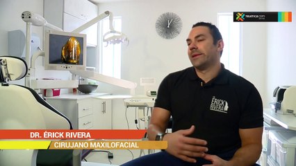 bd-importancia-de-extraxión-de-las-cordales-110419