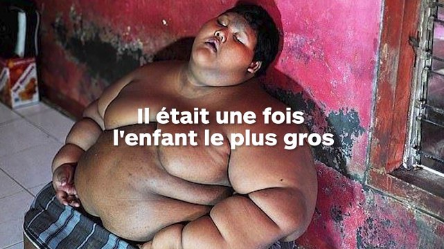 L'ancien enfant le plus gros du monde a perdu la moitié de son poids !