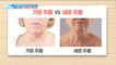 [BEAUTY] Vertical wrinkles, horizontal wrinkles? My body has a growth ring,기분 좋은 날20190412