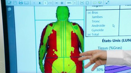 Santé - Gras, ventre et diabète